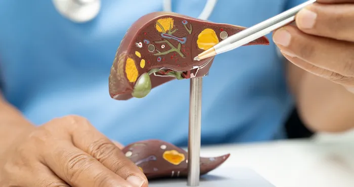cancer-du-foie-le-nombre-de-cas-pourrait-doubler-dici-a-2050