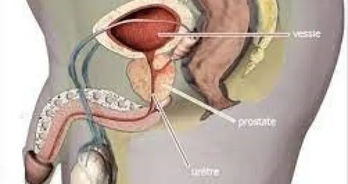 allo-docteur-tout-savoir-sur-le-cancer-de-la-prostate