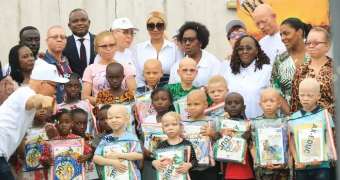 rentree-scolaire-emma-lohoues-comble-des-enfants-albinos