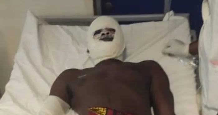 korhogo-des-personnes-brulees-a-lexplosion-dun-camion-citerne-de-carburant